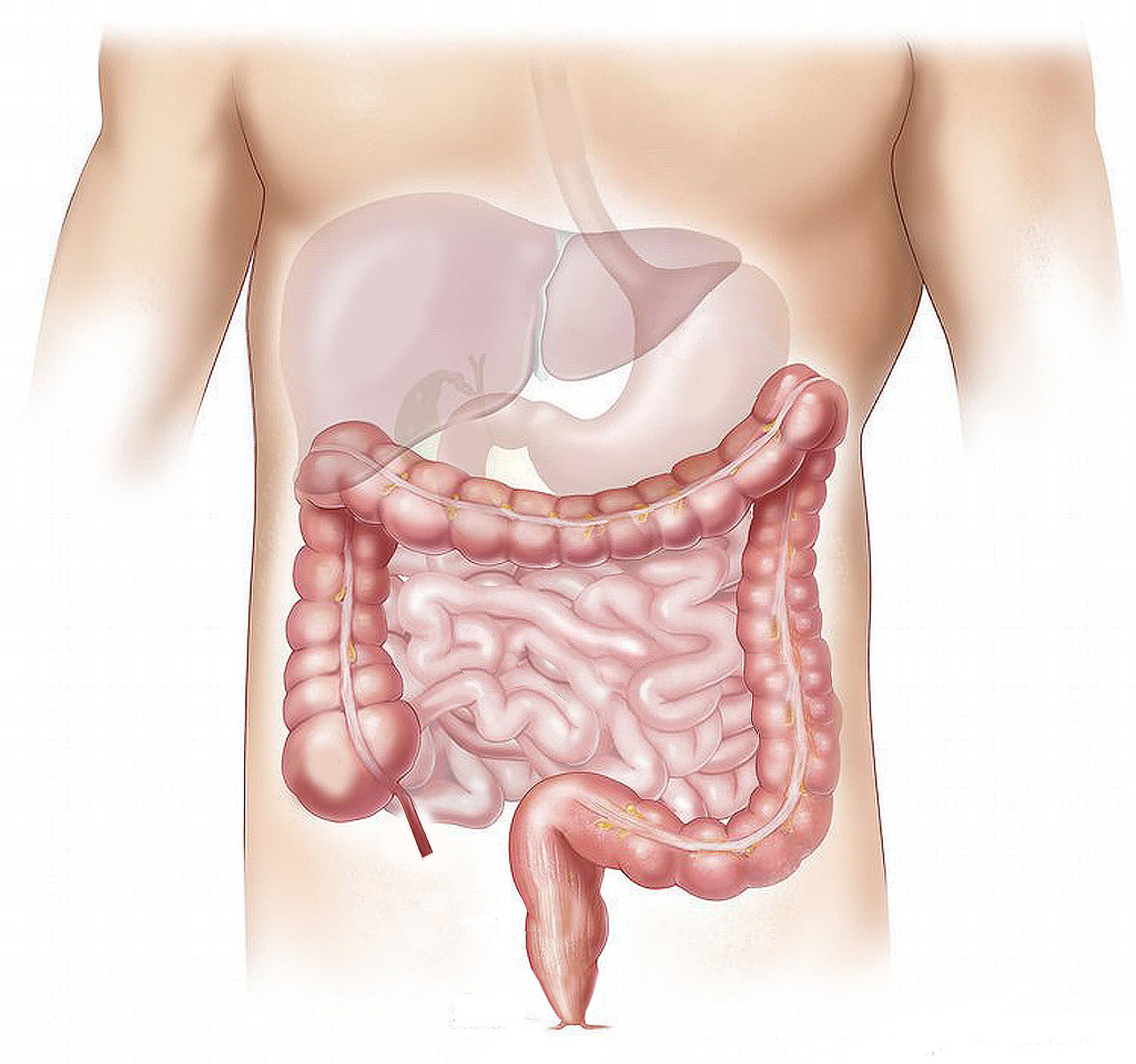 MVP-mediated exosomal sorting of miR-193a promotes colon cancer progression